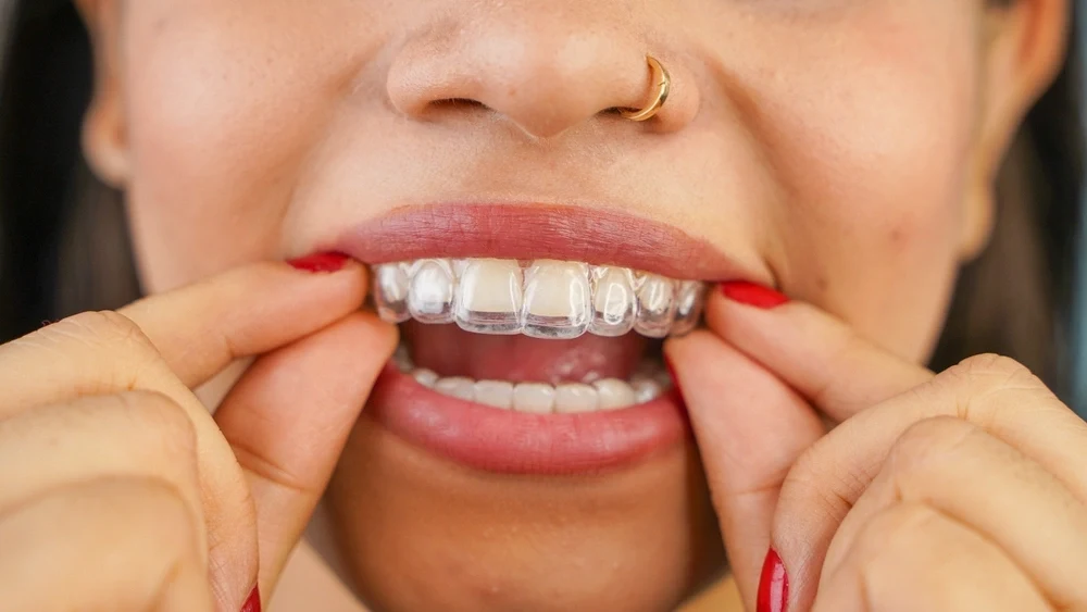 Patient holding clear Invisalign aligners